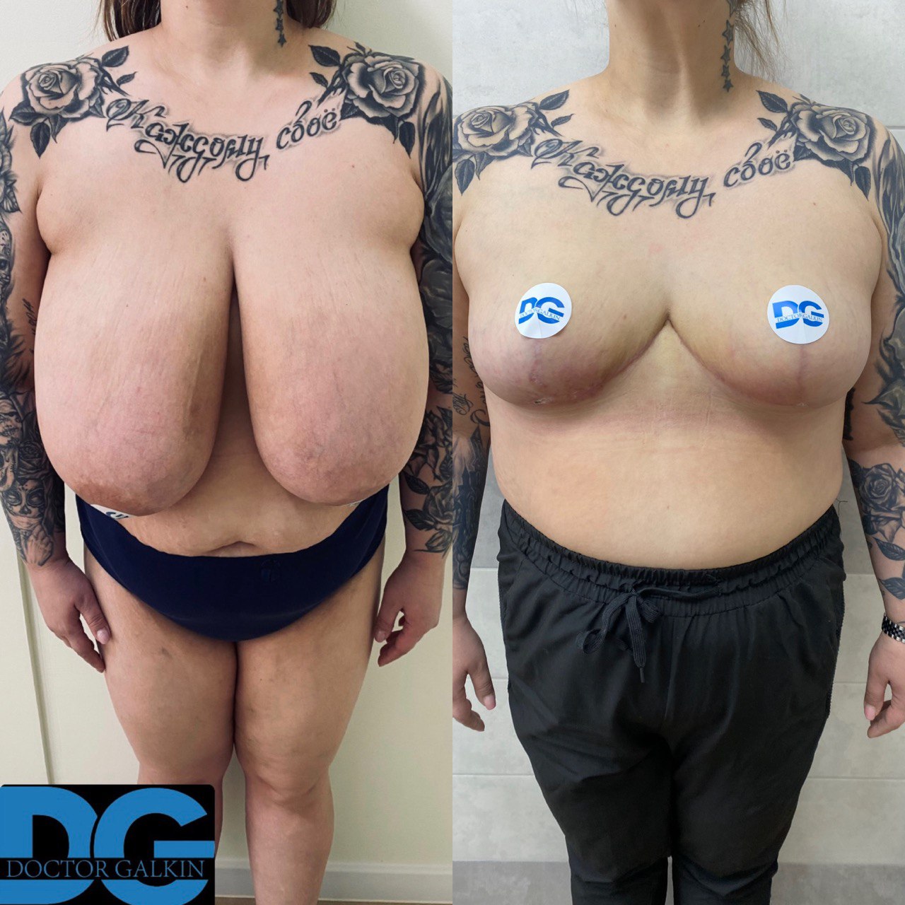 Before and after photo 2