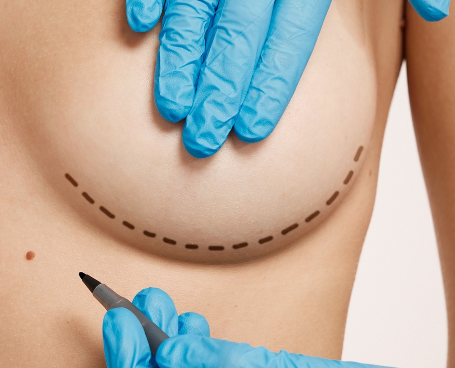 Procedure illustration